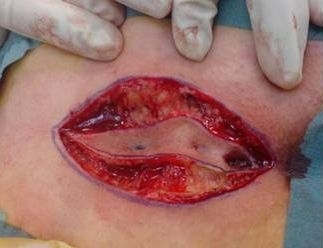 http://www.worldwidewounds.com/2009/December/Fette/images/1.jpg